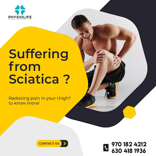 Sciatica is nerve pain from an injury or irritation to the sciatic nerve, which originates in you…