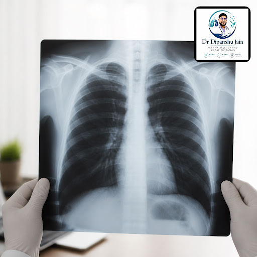 Precise chest X-ray reading can be the difference between guesswork and a clear diagnosis. At the… post image