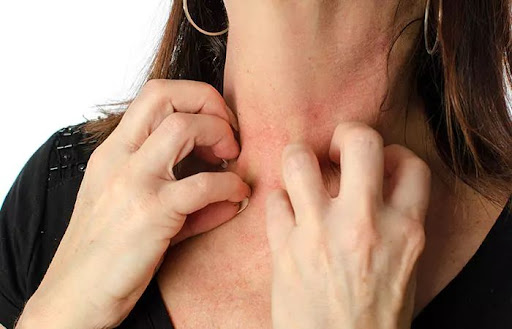 Persistent skin itching or rashes?  It could be a sign of al