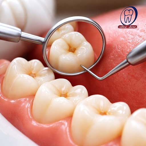 Tiny cavity, big problem later. In the early stage, tooth decay is painless and often invisible t… post image
