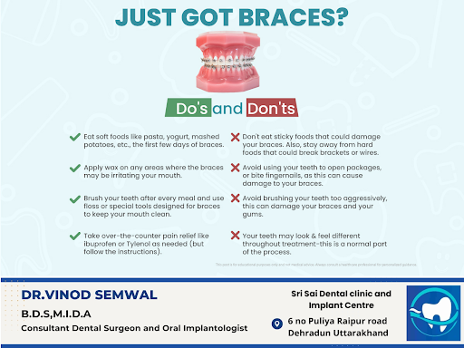 Just got braces? Follow these do's and don'ts to keep your treatment on track. Eat soft foods, av…