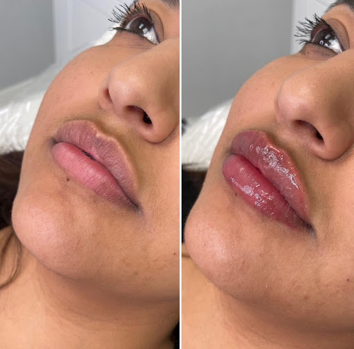 The Flawless Lab - Medspa