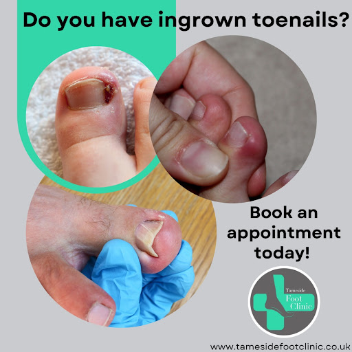 Tameside Foot Clinic - Thumbnail
