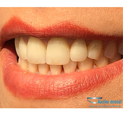 KERİMDENTAL Ağız ve diş sağılığı Polikliniği