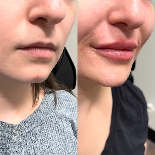 Lifted Aesthetics Charlotte