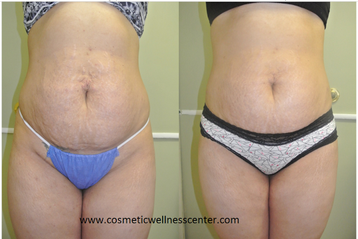 Cosmetic Wellness Center