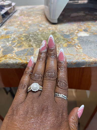 V Spa Nail - Visual