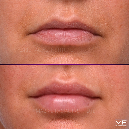 Mabrie Facial Institute