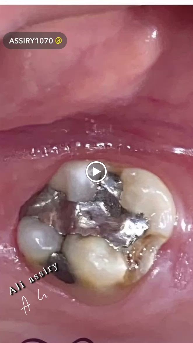 عيادة البرفيسور علي عسيري استشاري طب وجراحة أسنان الأطفال وذوي الاحتياجات الخاصة - صورة 3