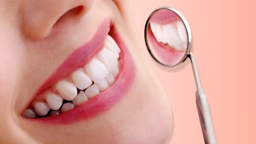 Your smile is more than just a facial feature—it reflects your confidence, personality, and how y… post image