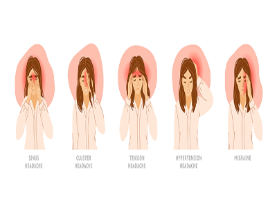 Types of Headaches: Sinus headache, cluster headache, tension headache, hypertension headache, au… post image
