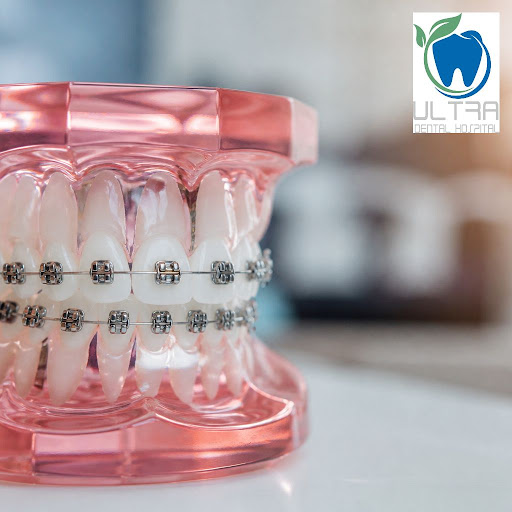 Want a straighter smile in less time and with more comfort? At Ultra Dental hospital and implant… post image
