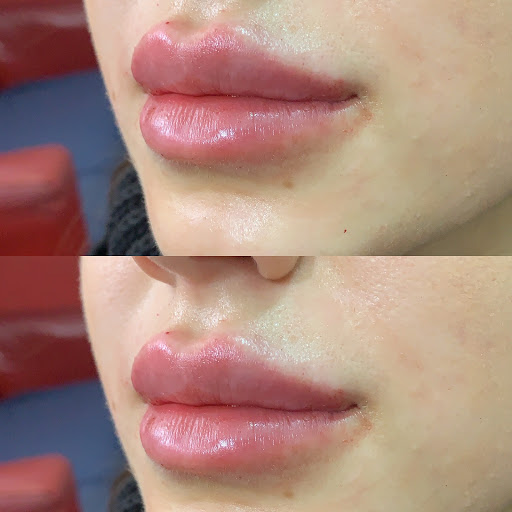 Klinik Refine - Thumbnail