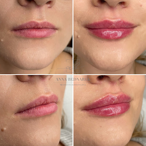 Bednarek Clinic Szczecin - lekarz medycyny estetycznej, kosmetolog, dermatolog, plastyka powiek, botoks, modelowanie ust - Salon piękności
