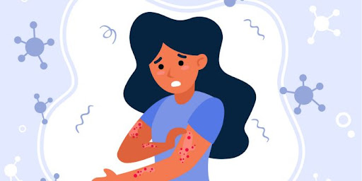 Skin Allergy