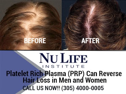 A Remarkable New Hair Loss Treatment In Miami For Thinning Hair River Country News Channel Nebraska