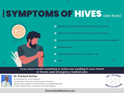 If you have trouble breathing or notice any swelling in your mouth or throat, seek emergency medi… post image