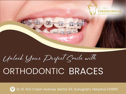 At Dr. Megha’s Tooth House – Multispeciality Dental Clinic, orthodontic care is approached with c…