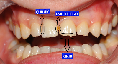 Diş Hekimi Murat Seyitoğlu