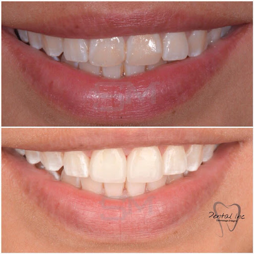 LIHE, Dentista Monterrey - Thumbnail