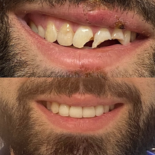 Dentist Near Me Chino - Thumbnail