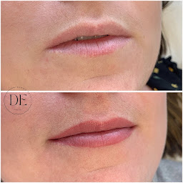 Photo n°4 de Cabinet DERMO ESTETIC à Douvaine (Clinique de maquillage permanent)