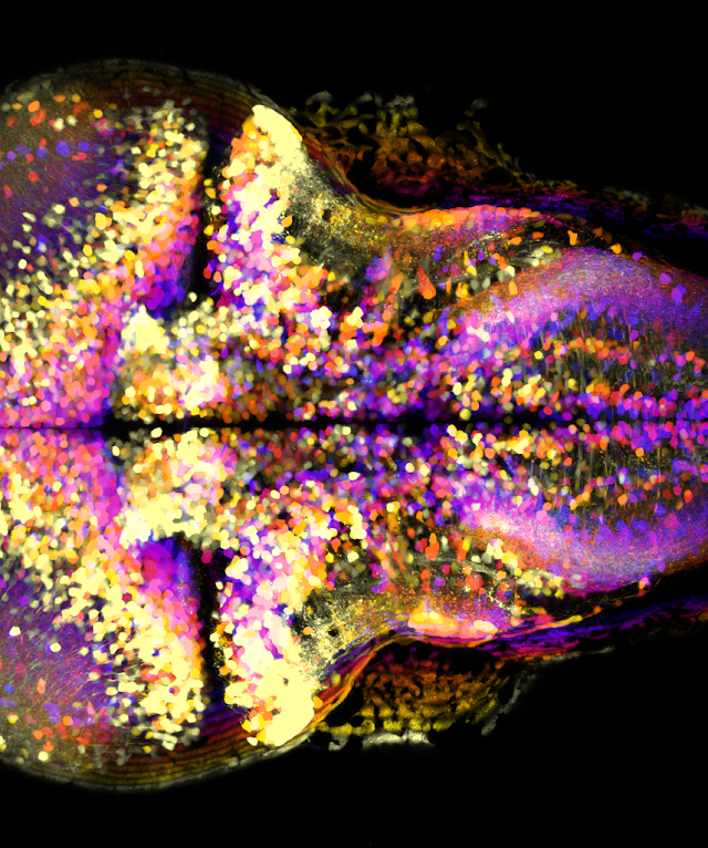 ICM Institut du Cerveau et de la Moelle épinière