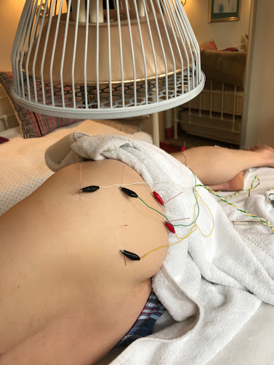 Laura Boscawen Acupuncture & Massage - BSc, BSc, LicAc, BTEC5, MBAcC - Thumbnail