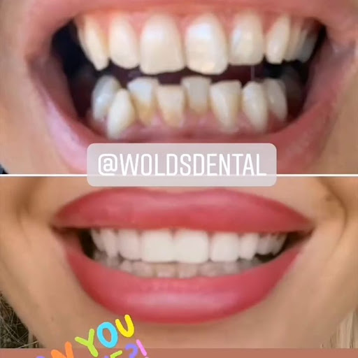 Wolds Dental Studio - Thumbnail