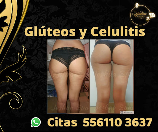 Yeshua Spa Roberto - Thumbnail