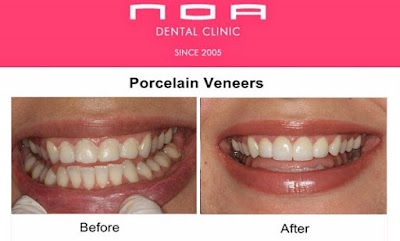Photos of NOA Dental Clinic Dubai