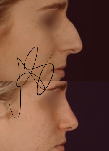 Dr. Angelo Sapuppo - Chirurgo Plastico - Thumbnail