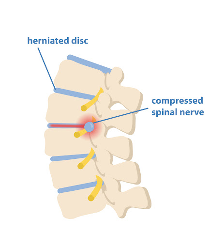 At Neurology and Physiotherapy Clinic in Delhi NCR, we offer specialized physiotherapy and rehabi…
