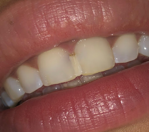 Bedwell Dental Practice Gallery - United Kingdom