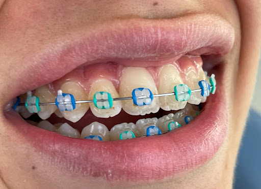 Dr. Giacomo D'Orlandi Ortodonzia e Dentista per Bambini - Thumbnail