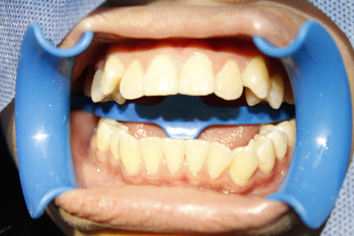 Clínicas Odontológicas de la UJAT-DACS - Thumbnail