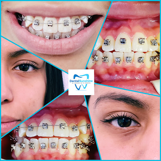 Dental Sunshine Gallery - Mexico