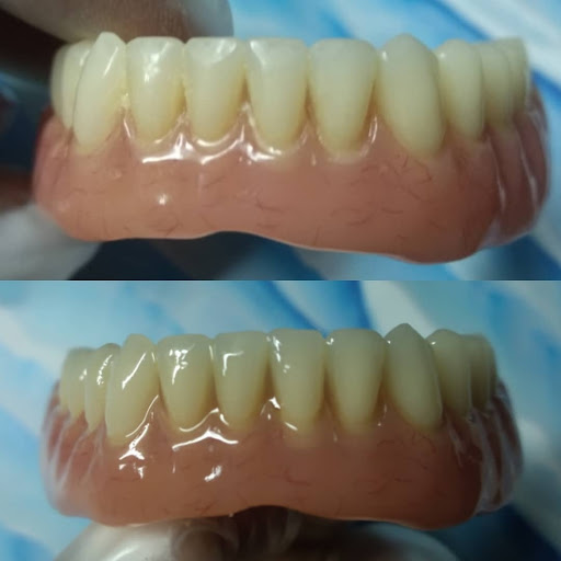 SALVADENT Centro de reparación de prótesis dentales - Thumbnail
