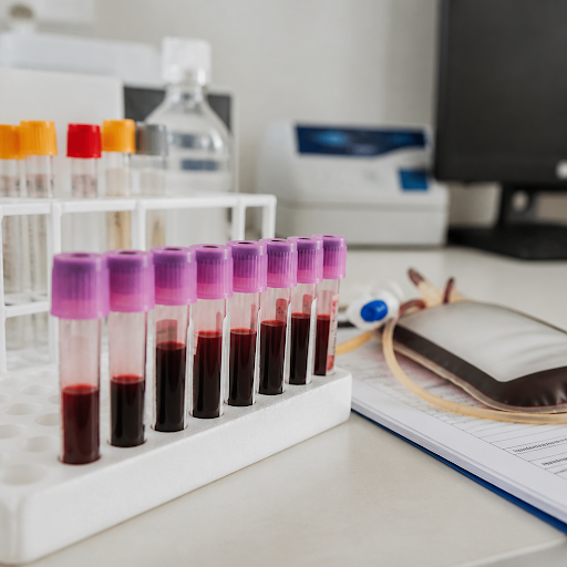 Knowing your blood group is a small step that can make a life-saving difference. At Akbarpur Char… post image