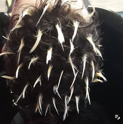 Photo n°18 de Millenium Coiffure & Barbier/colmar à Colmar (Clinique de transplantation de cheveux)