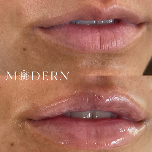 Modern SLC Injections & Aesthetics