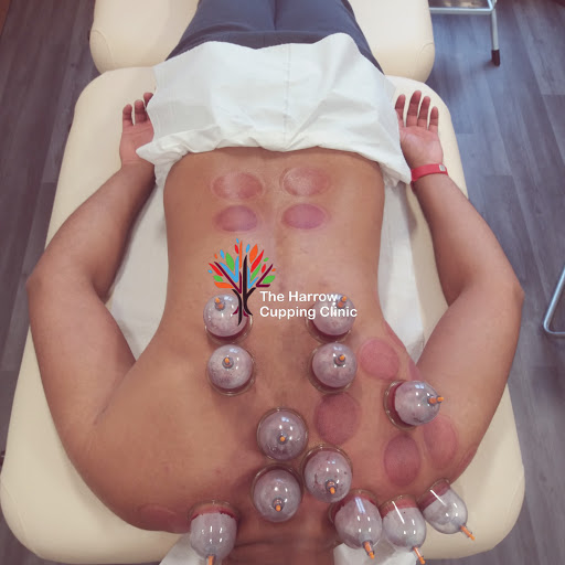 The Harrow Cupping Clinic - Hijama Therapy in London