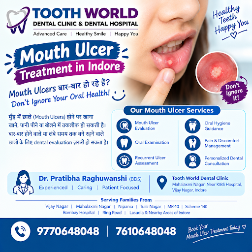 🦷 Mouth Ulcer Treatment in Indore post image