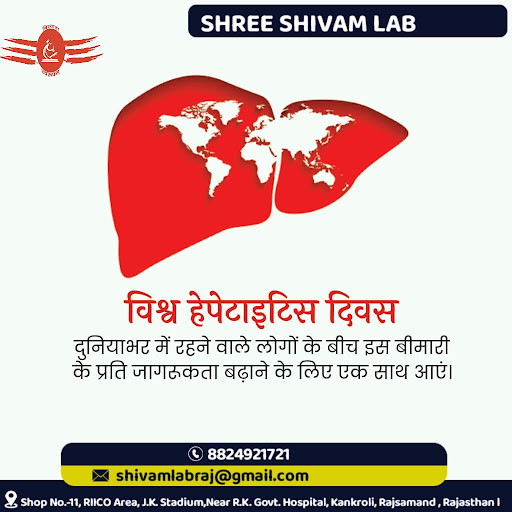 🌍 विश्व हेपेटाइटिस दिवस: स्वस्थ लीवर, खुशहाल जीवन! ❤️आपका लीवर आपके शरीर का इंजन है, जो बिना रुके… post image