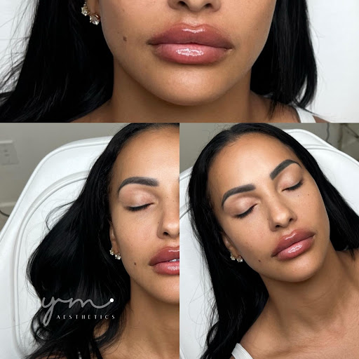 YM Aesthetics Clinic Miami