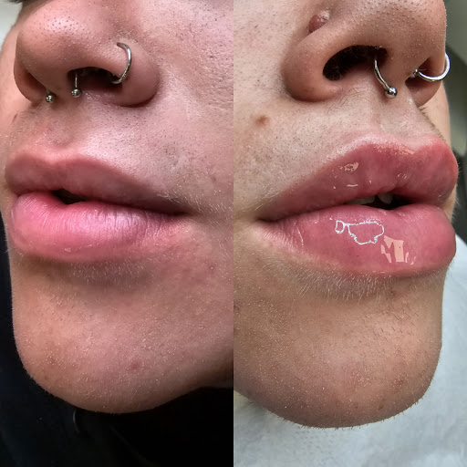 Vale Royal Aesthetics & Laser