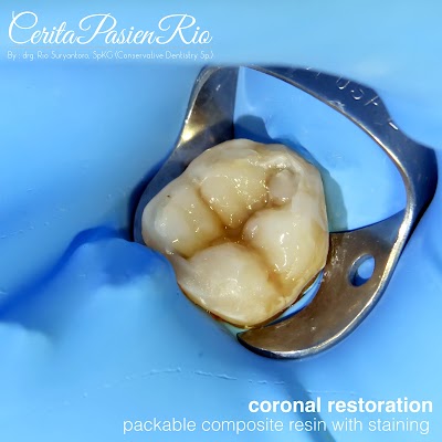 Photos of Spesialis konservasi gigi (endodontist) drg. Rio Suryantoro, SpKG