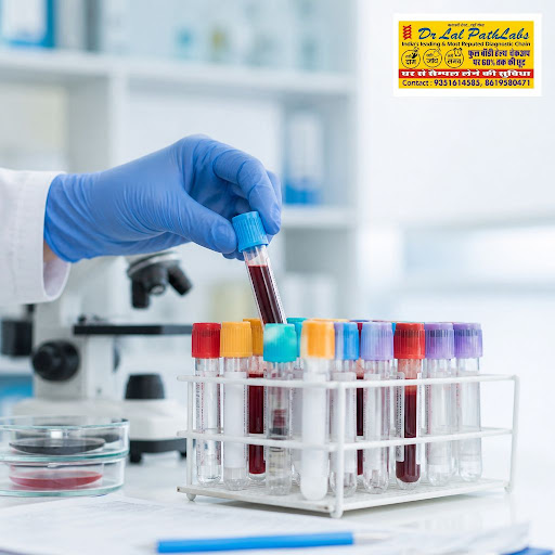 Stay a step ahead of infections with accurate, early detection at Dr. Lal Path Labs, Imli Phatak,… post image
