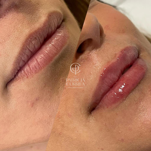 Dra Patricia Correa | Clínica de Medicina Estètica Gallery - Spain