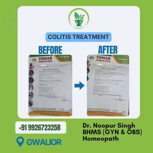 क्या आप कोलाइटिस (Colitis) या पाचन संबंधी समस्याओं से परेशान हैं? 🌿